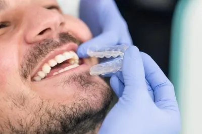 patient being fitted with new Invisalign clear aligners